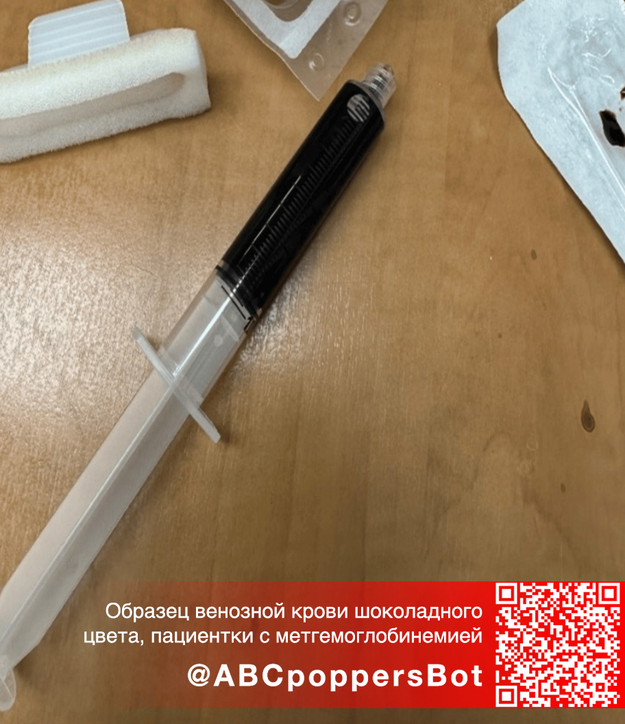 Если принять попперс внутрь в Симферо́поле это вызывает метгемоглобинемию. Смертельное состояние Если принять попперс внутрь в Симферо́поле это вызывает метгемоглобинемию. Смертельное состояние